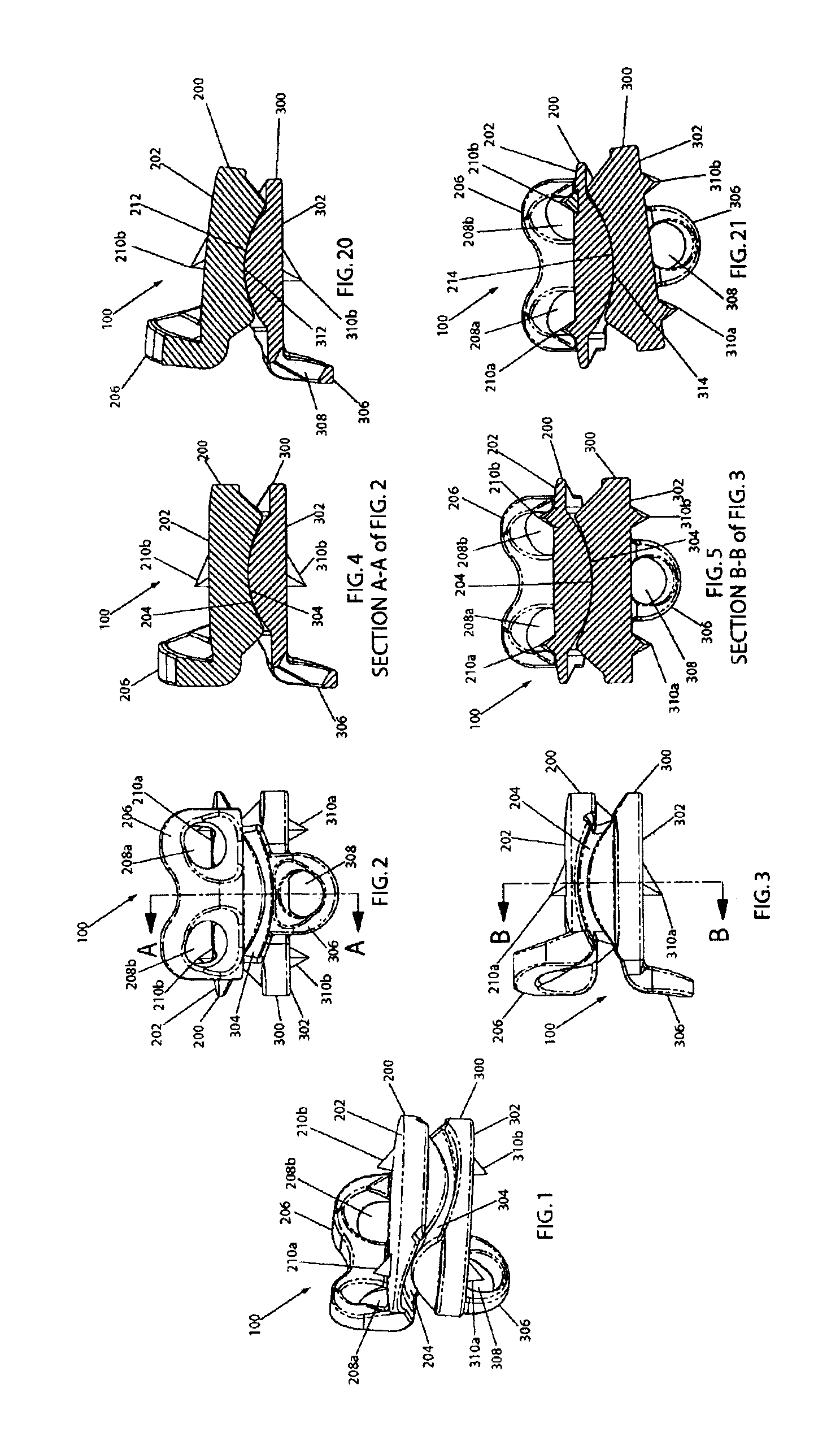 Cervical disc replacement