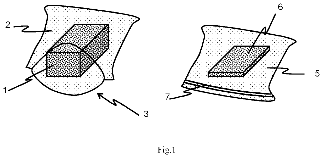 Expandalbe anode assembly