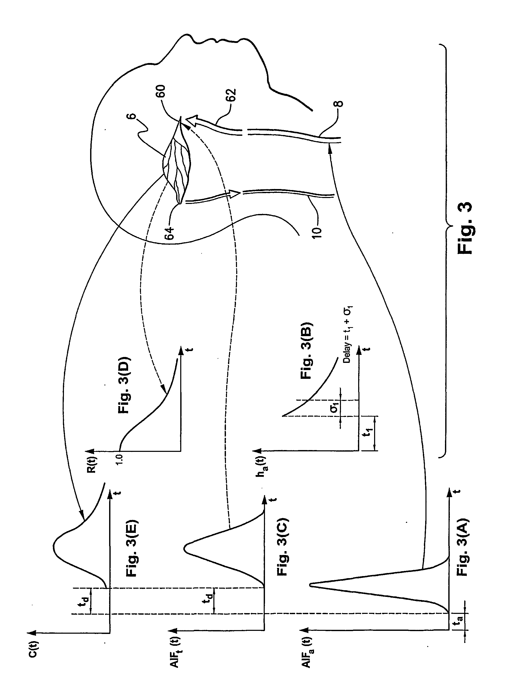 Method and system of obtaining improved data in perfusion measurements