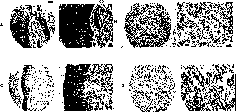 Cathepsin D antigen polypeptide and application thereof as well as detecting kit containing polypeptide