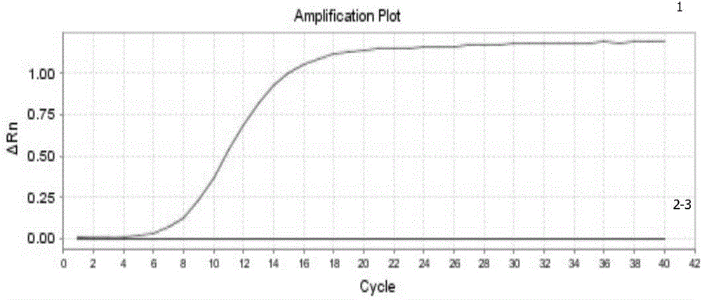 Fluorescence quantification RT-PCR (reverse transcription-polymerase chain reaction) detection kit of Eurasian avian-like type H1N1 swine influenza virus and application thereof