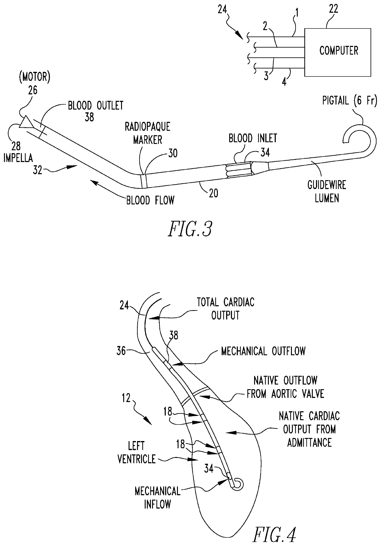 Method and Apparatus for Assisting a Heart