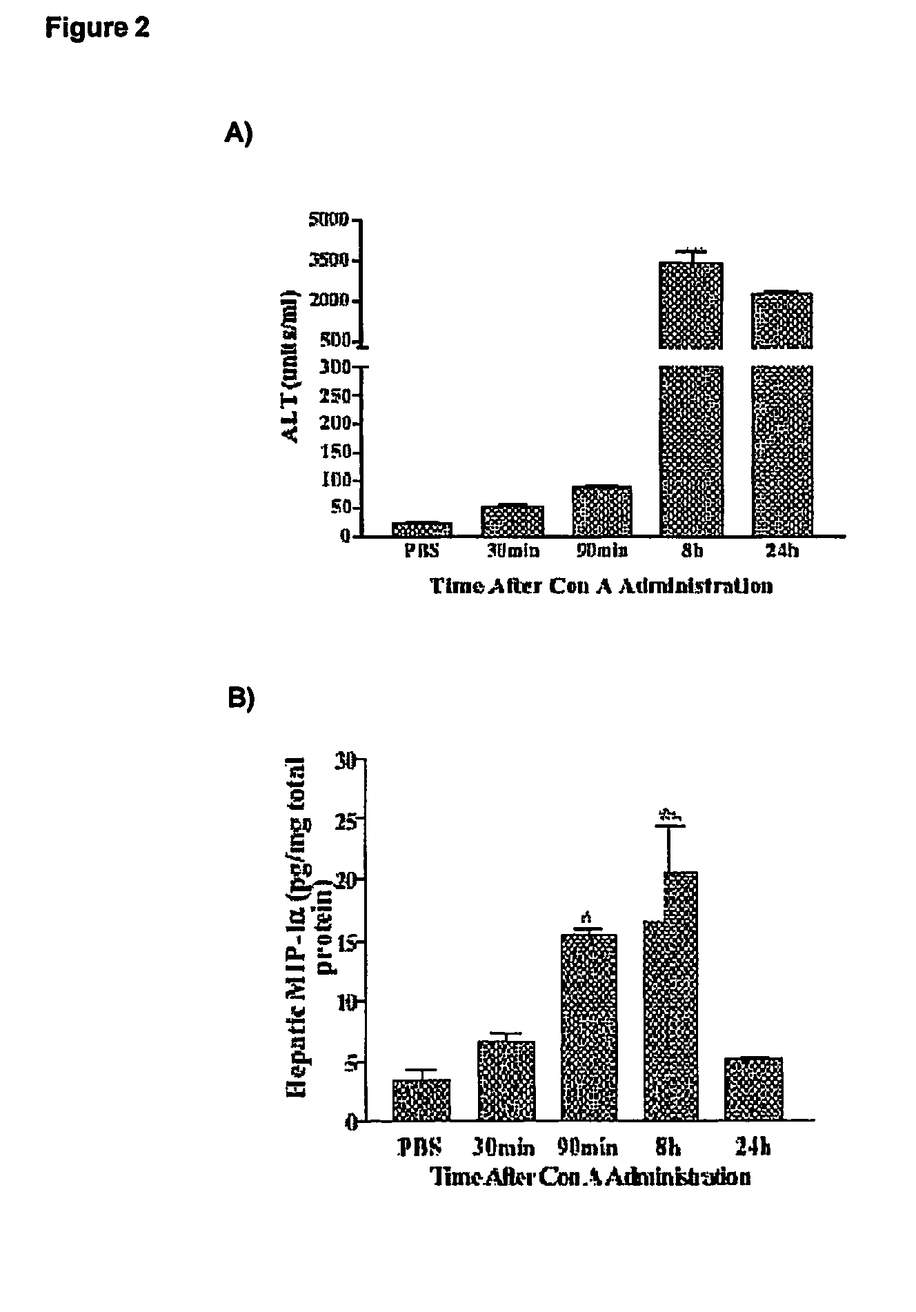 Methods of reducing serum alanine transferase levels in a subject with hepatitis