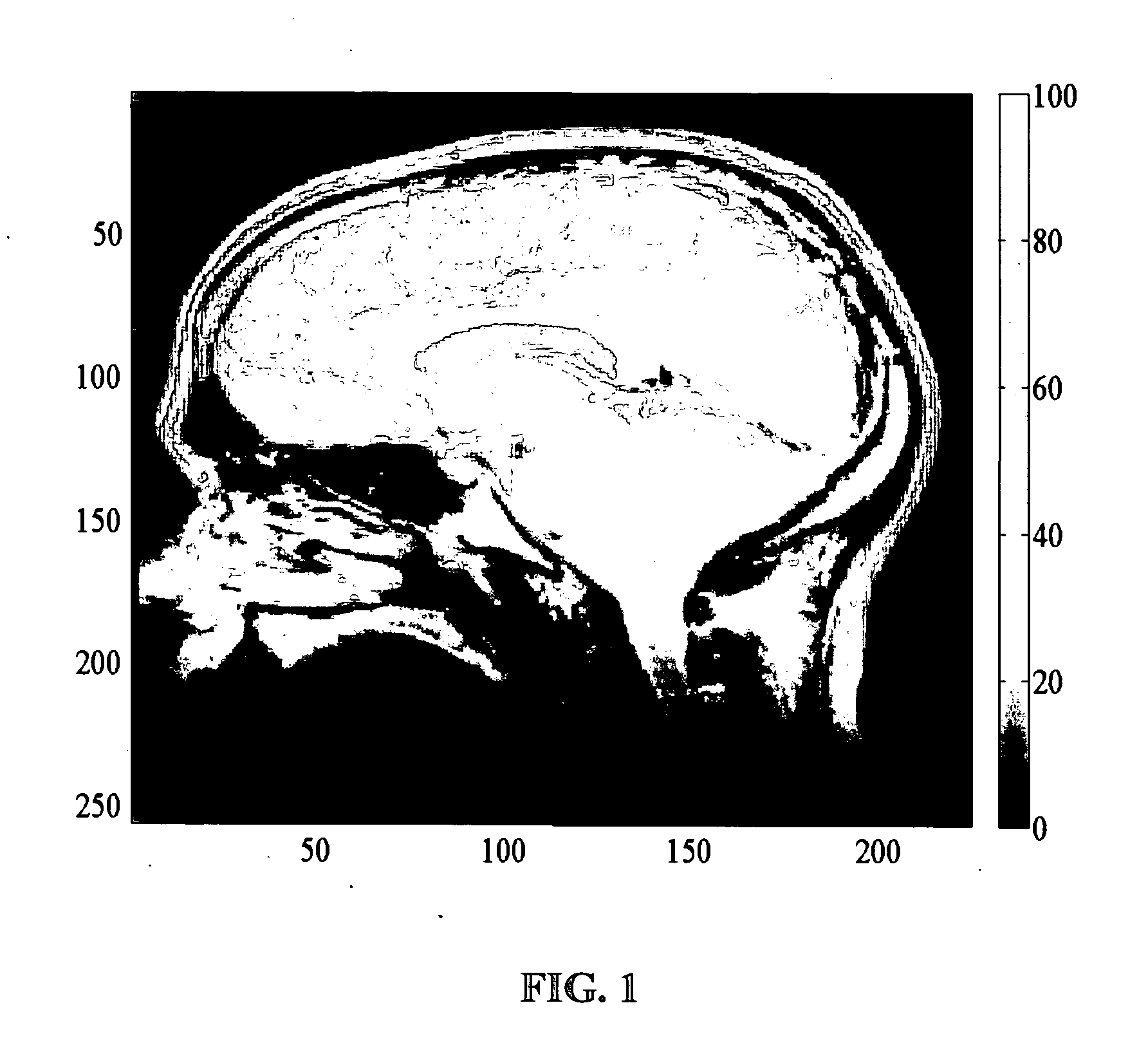 Method and apparatus for reconstruction of an image in image space using basis functions (RIB) for partially parallel imaging