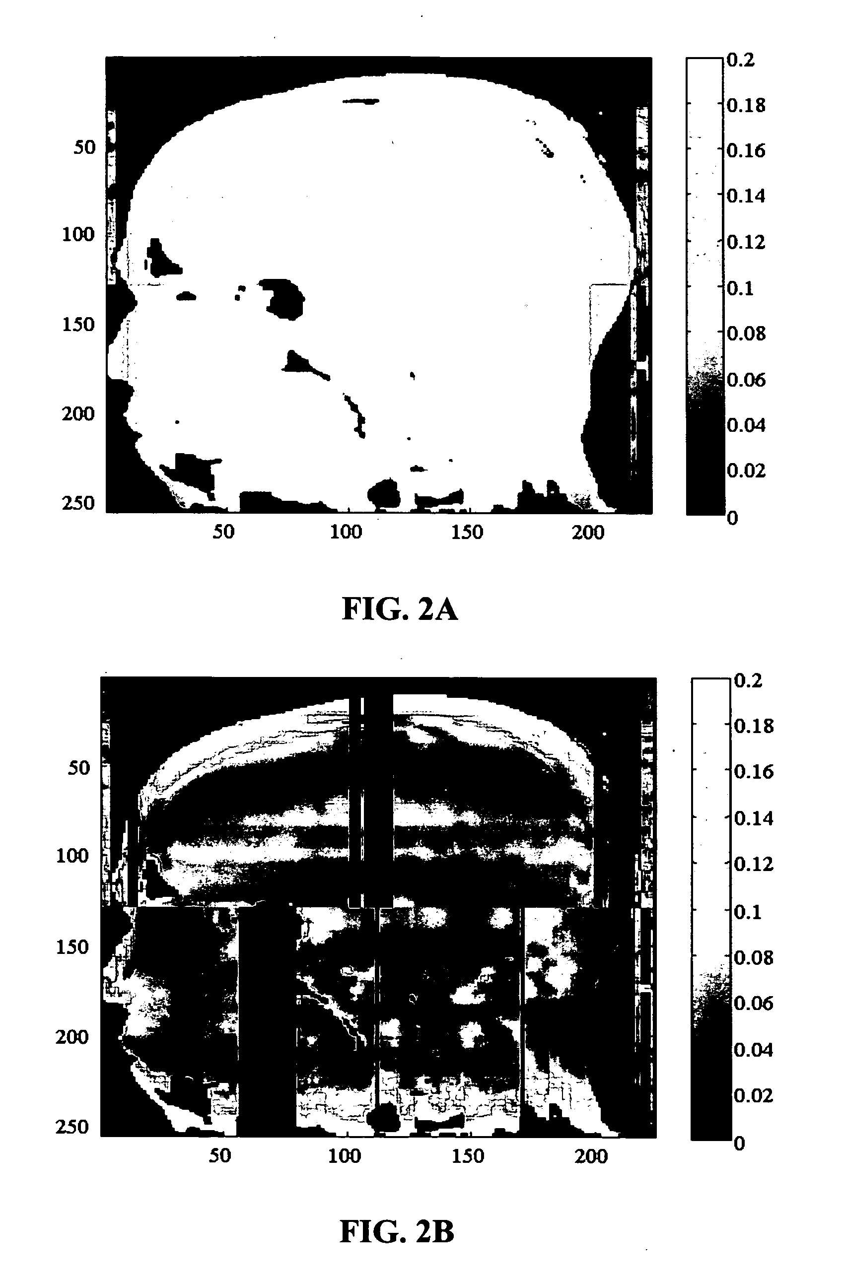 Method and apparatus for reconstruction of an image in image space using basis functions (RIB) for partially parallel imaging