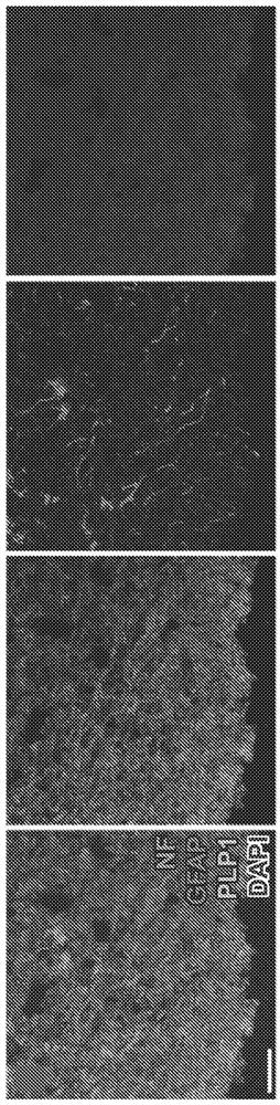 Induction of myelinating oligodendrocytes in human cortical spheroids