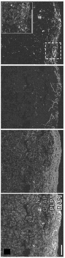 Induction of myelinating oligodendrocytes in human cortical spheroids