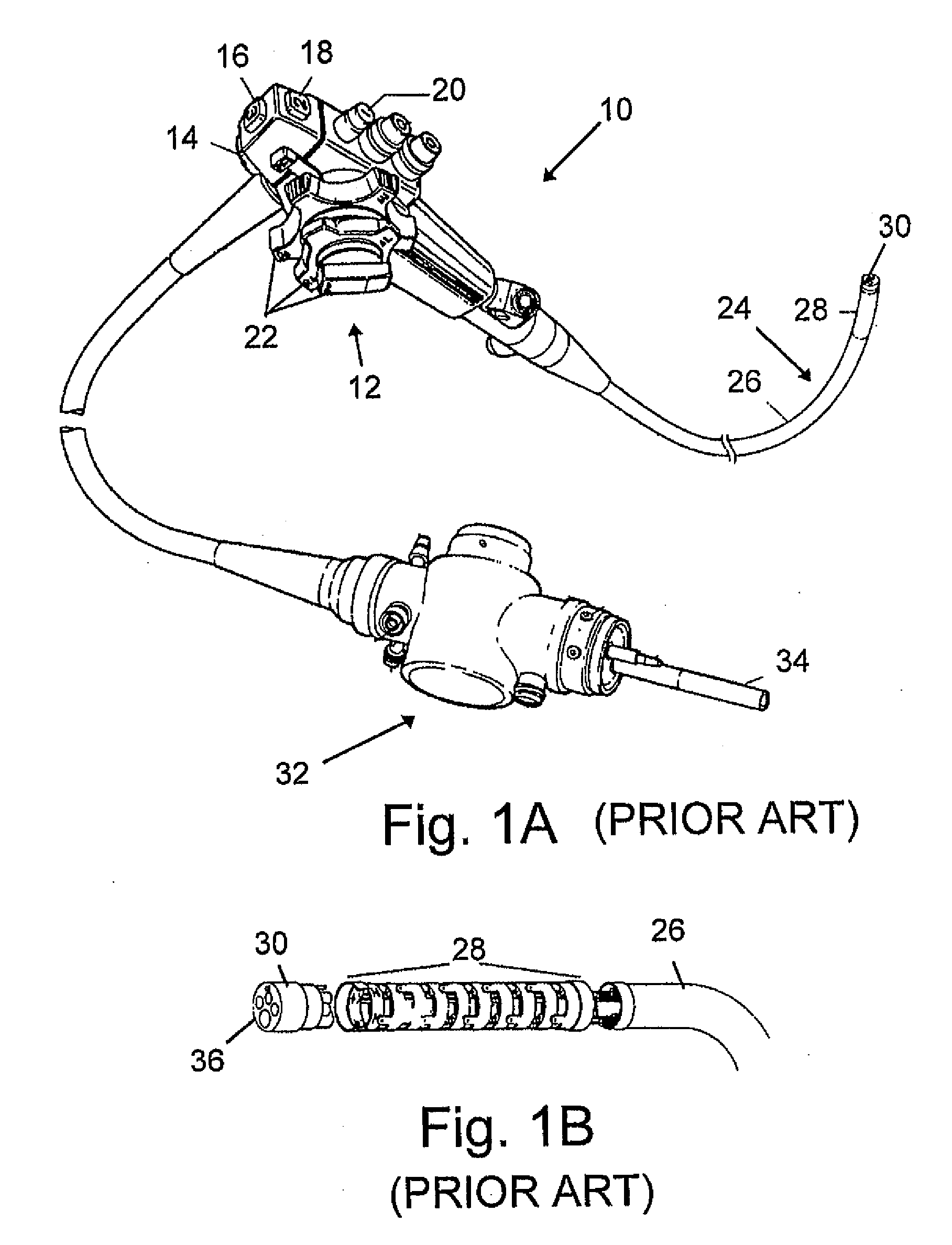 Devices and Methods for Treating Morbid Obesity