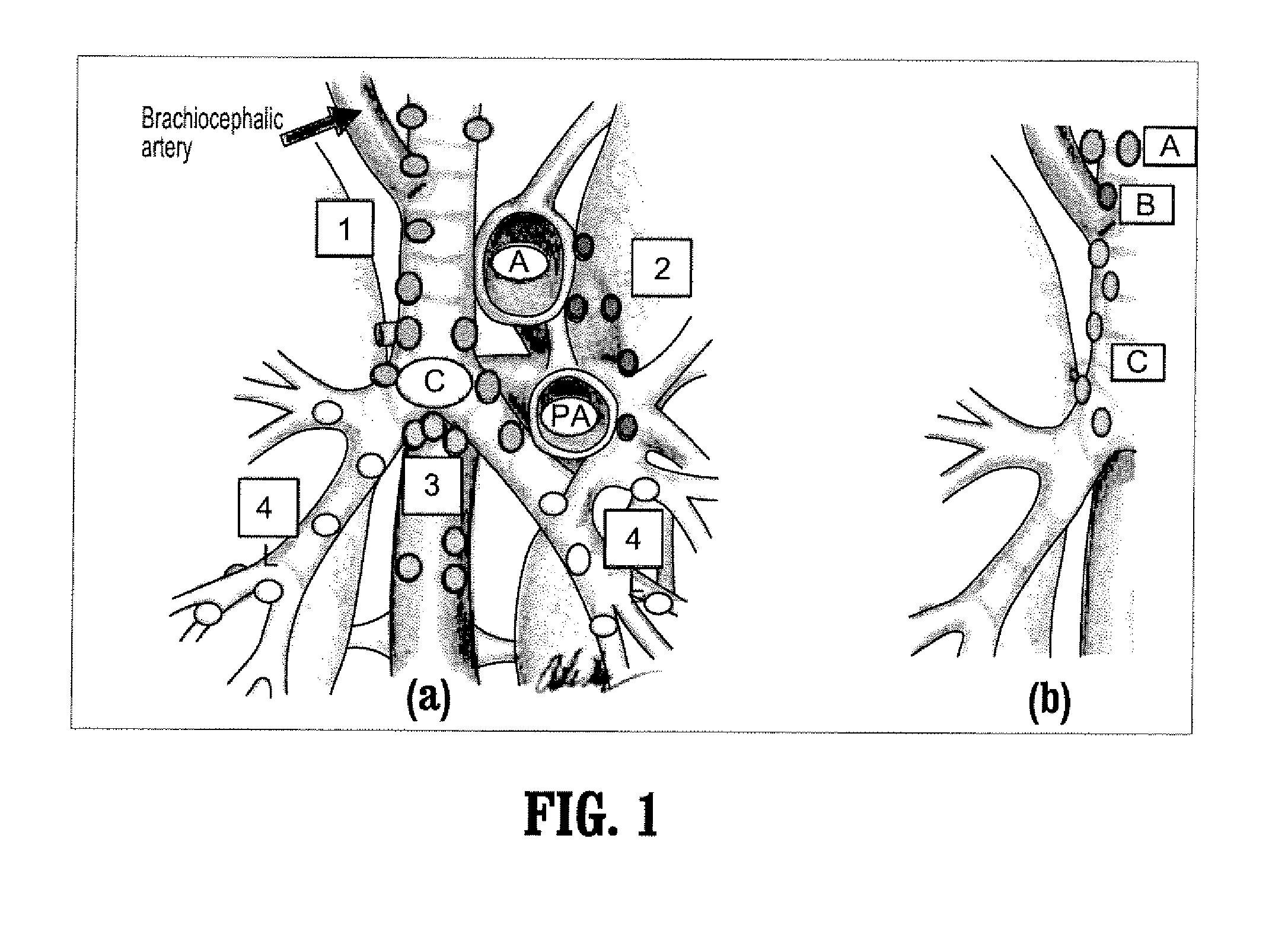 System and Method For Labeling and Identifying Lymph Nodes In Medical Images