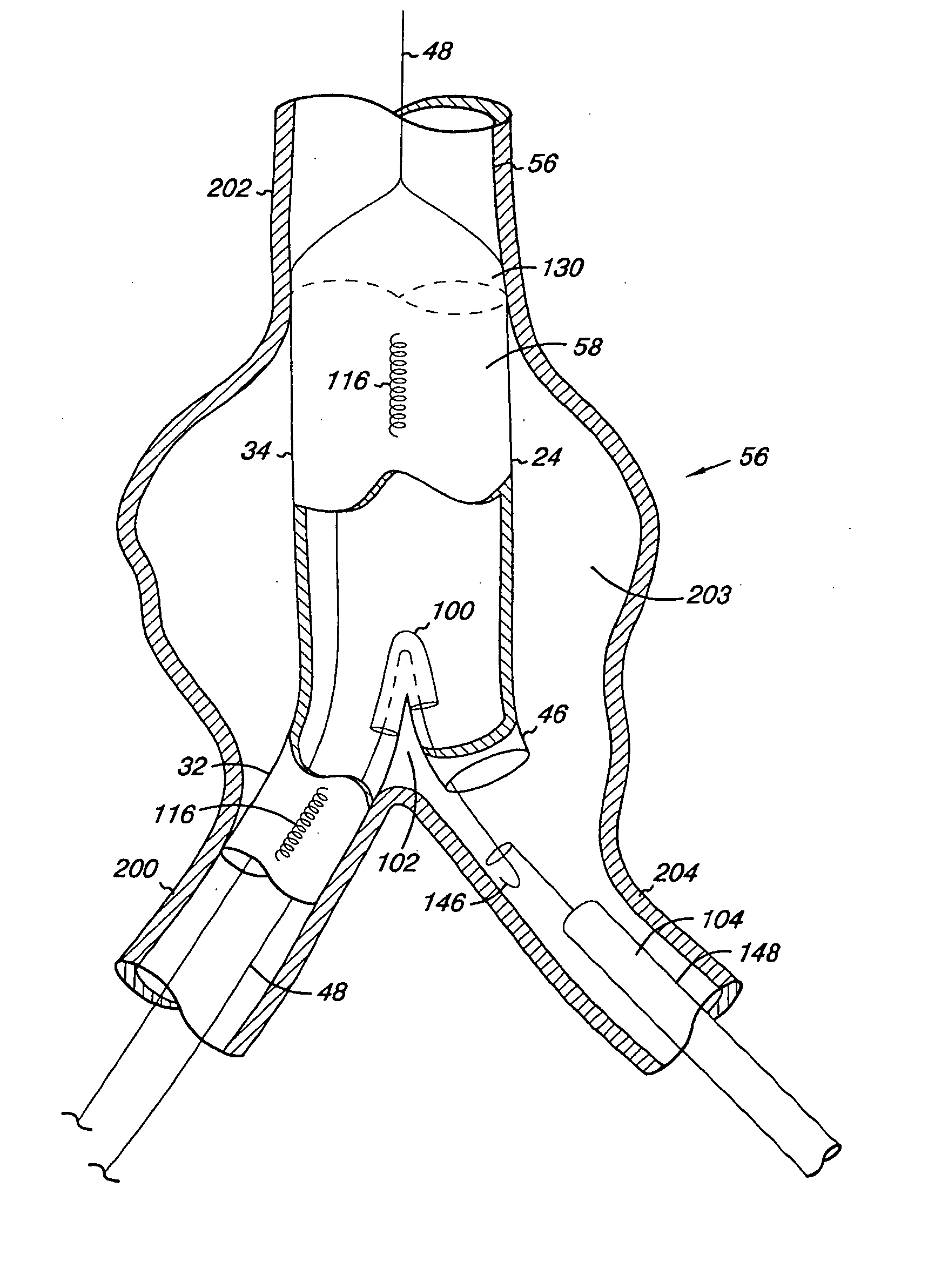 Endovascular graft including substructure for positioning and sealing within vasculature