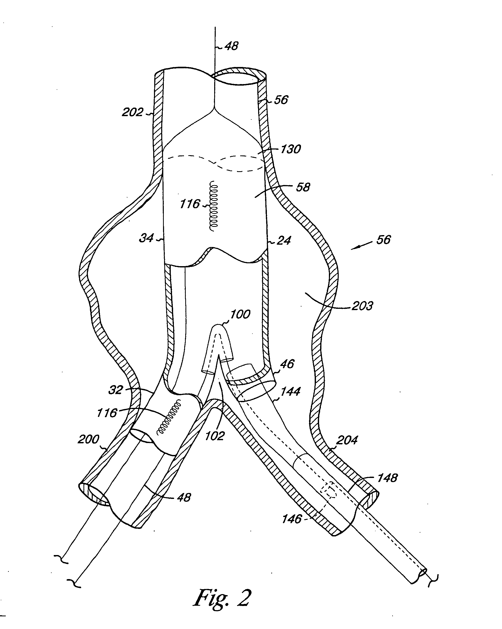 Endovascular graft including substructure for positioning and sealing within vasculature