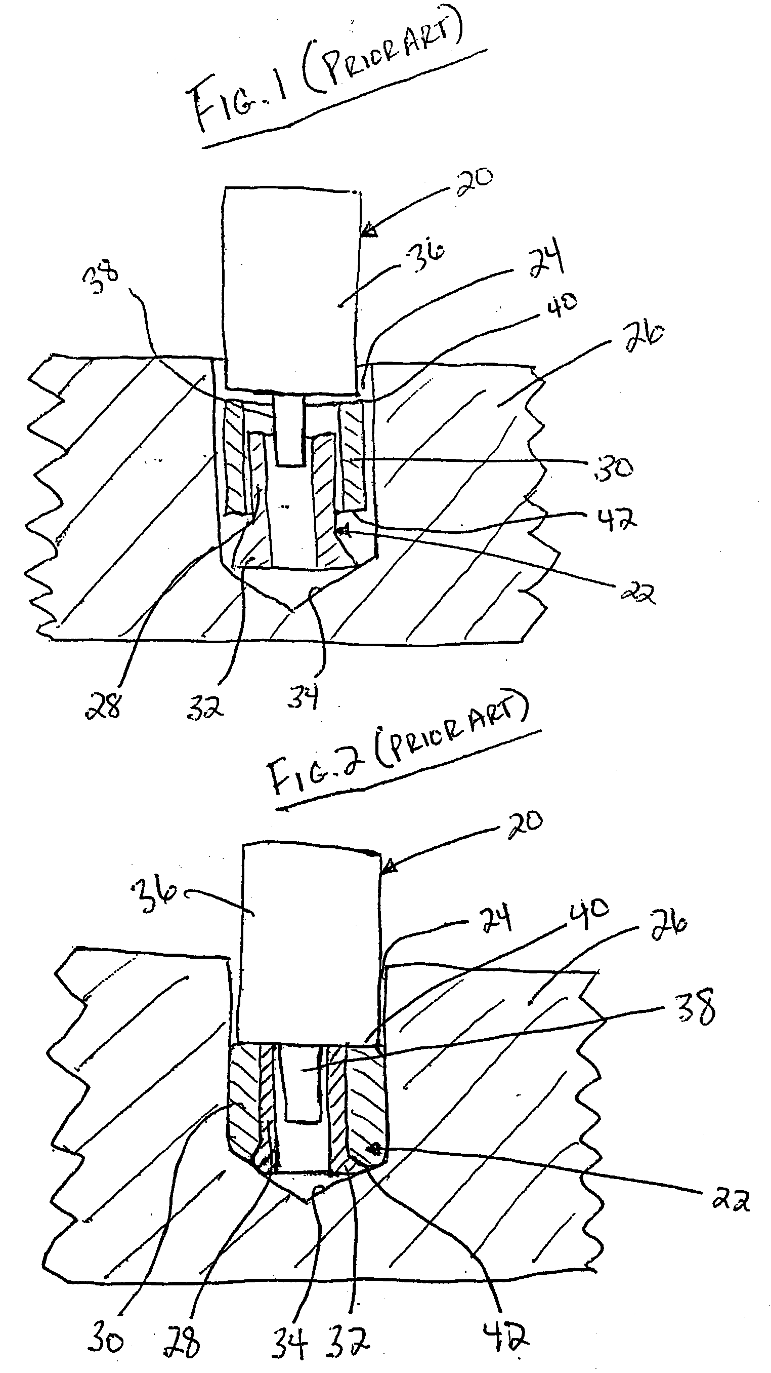 Installation tool for setting anchors