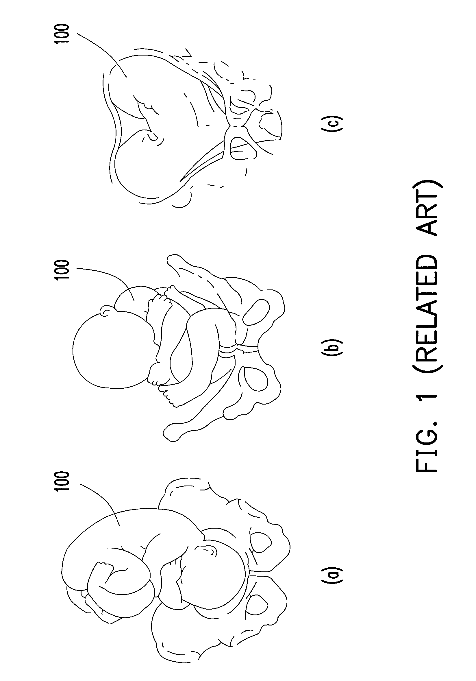 Apparatus and method for monitoring fetus in maternal body
