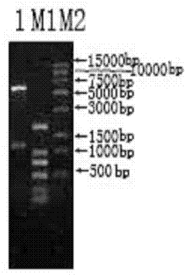 Riemerella anatipestifer antibody indirect ELISA method detection kit and application thereof