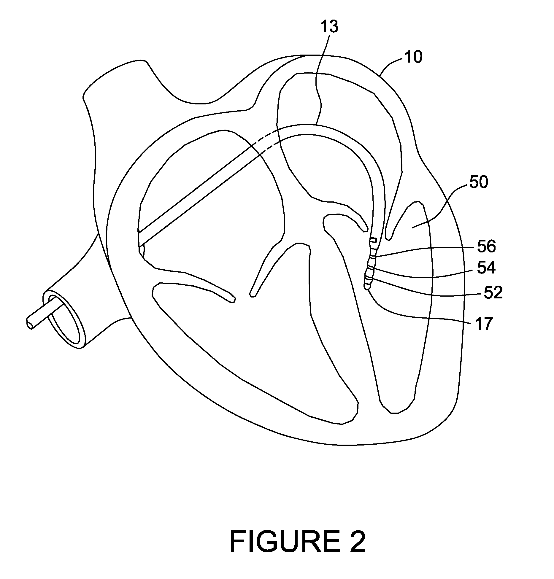 Cardiac mapping system and method for bi-directional activation detection of electrograms