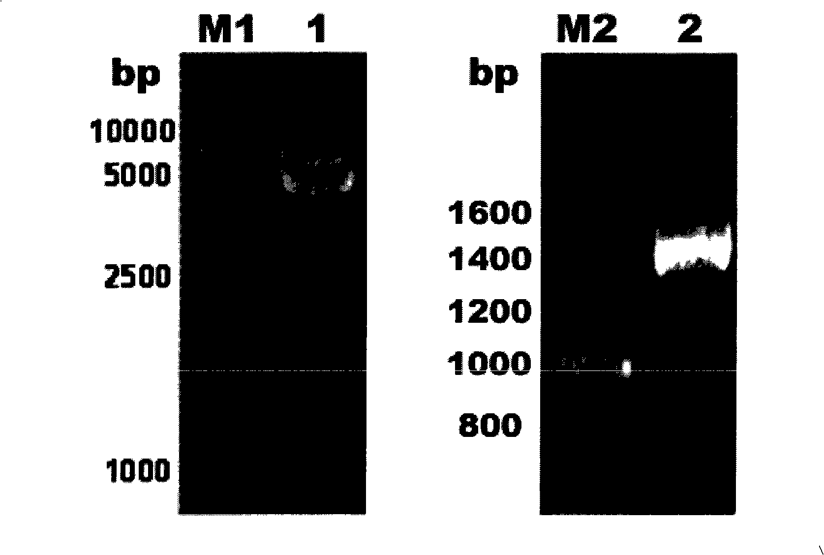 Preparation method of anti-human Nogo-66 receptor protein vaccine and application thereof