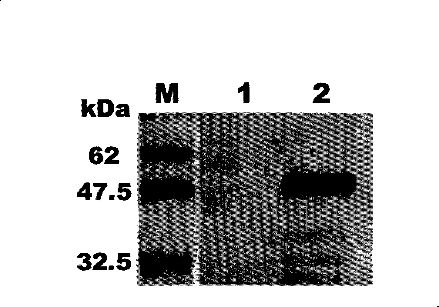 Preparation method of anti-human Nogo-66 receptor protein vaccine and application thereof
