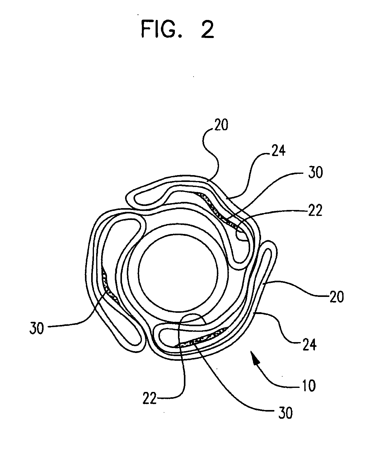 Selectively coated medical balloons