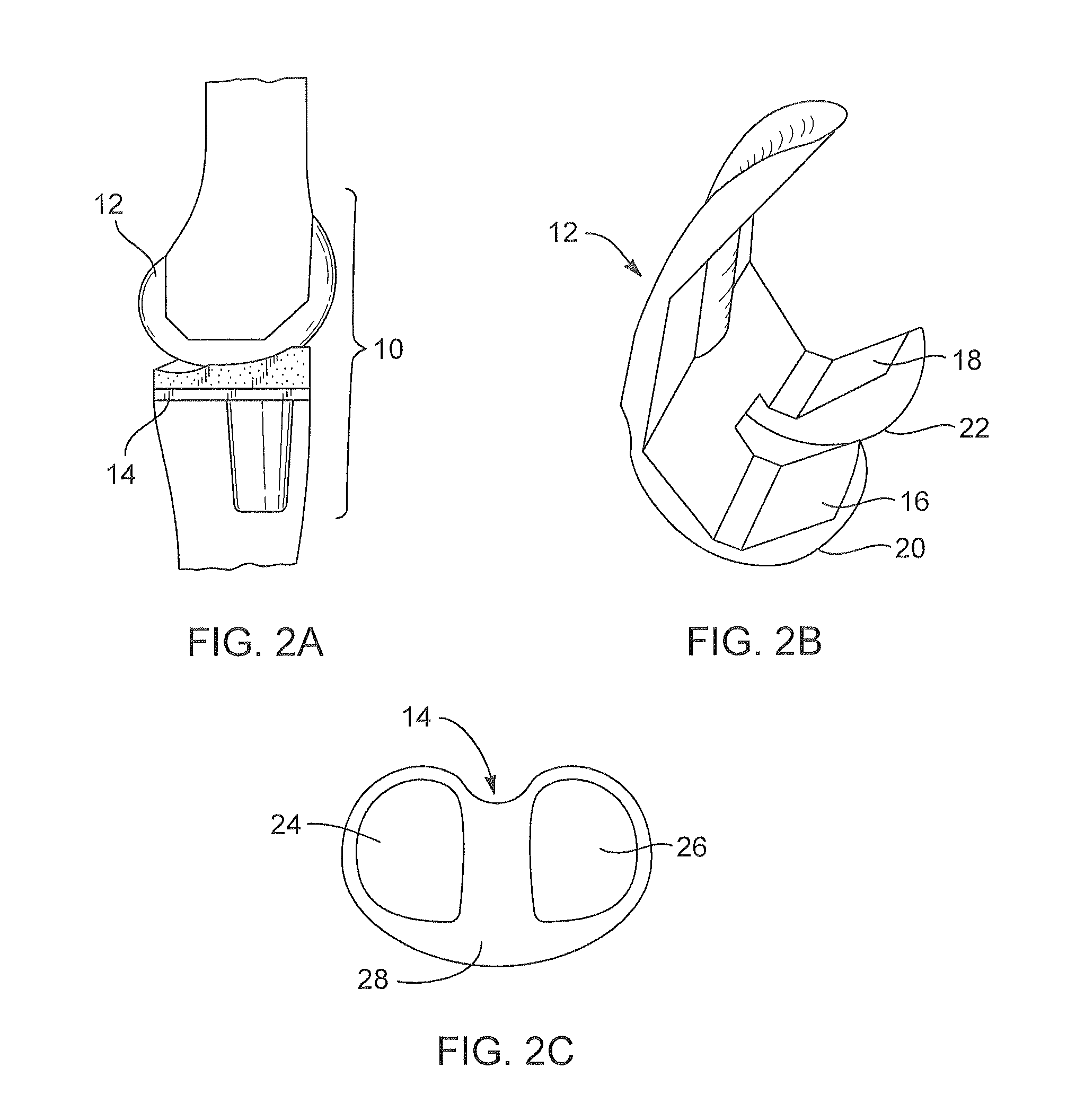 Systems and methods for providing a femoral component