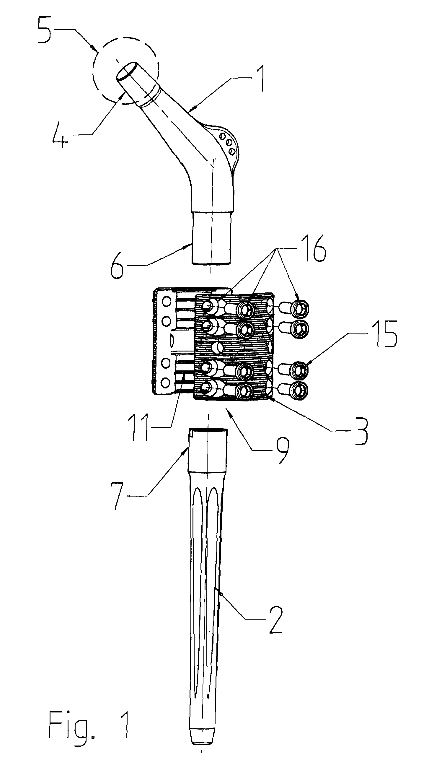 Modular Joint Prosthesis