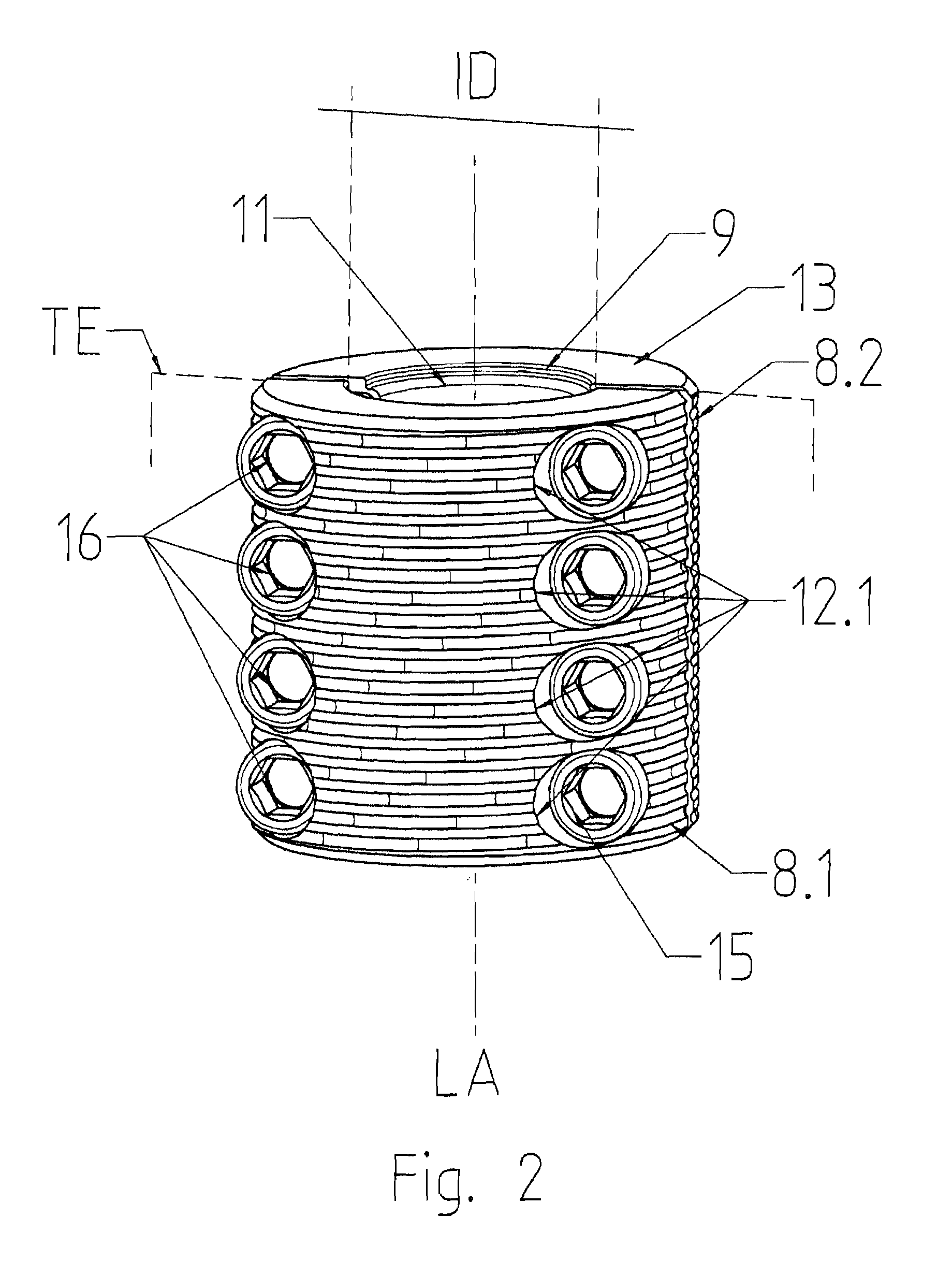 Modular Joint Prosthesis