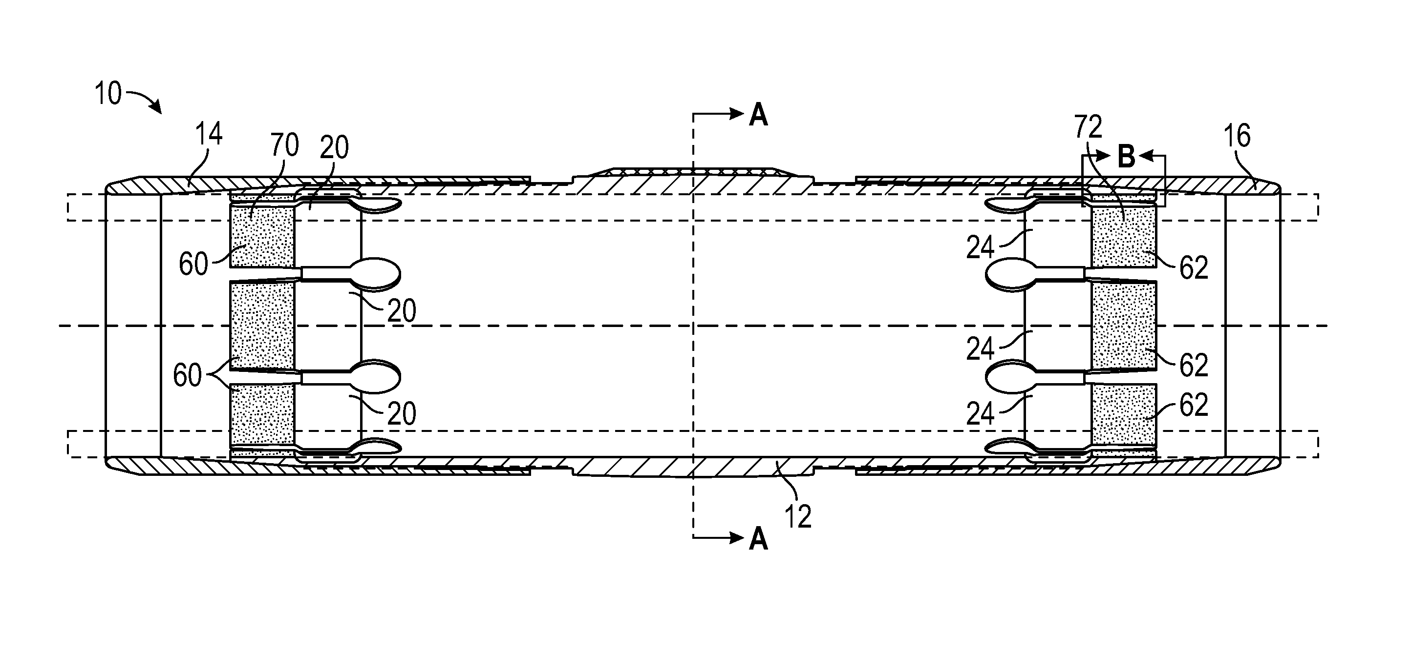 Stabilizer Assembly and Method