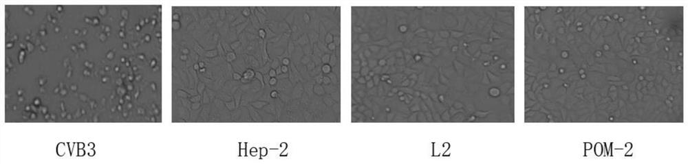 Application of iodo-hydrazide and iodo-hydrazide polyacid derivative in preparation of anti-CVB3 virus drugs