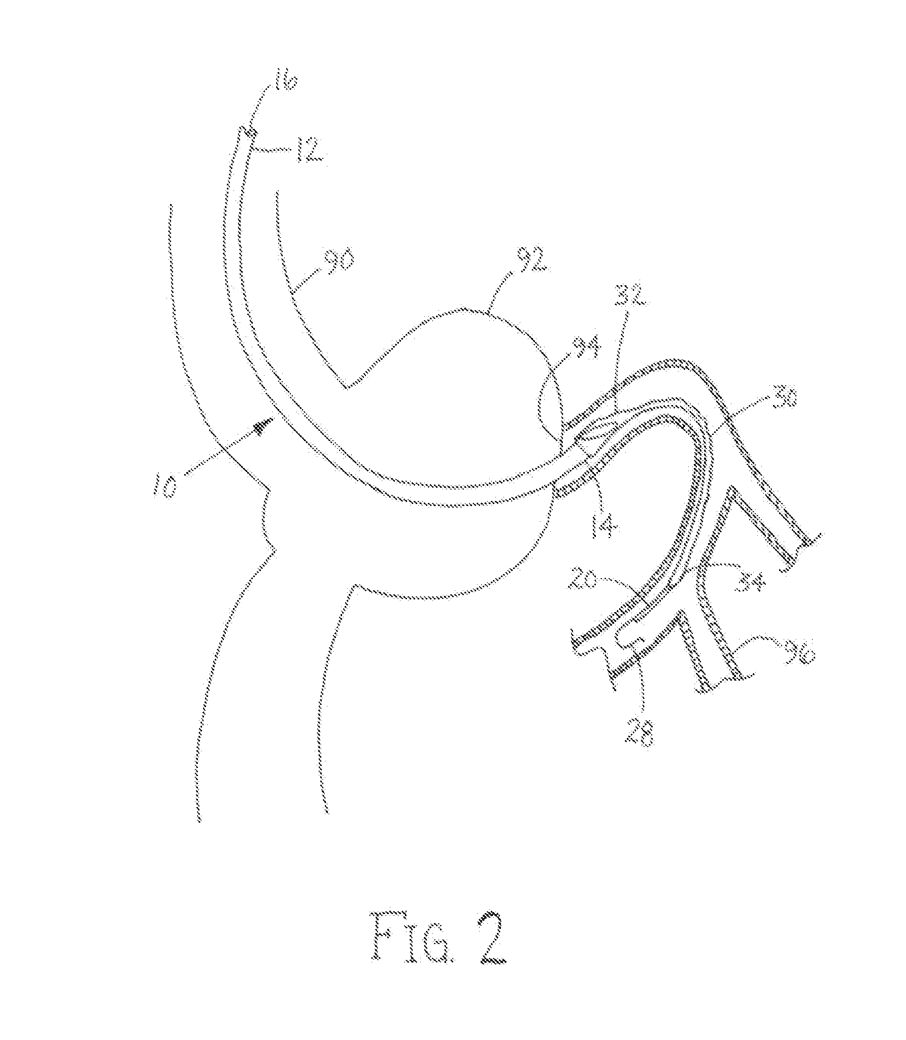 Apparatus and methods for delivering stem cells and other agents into cardiac tissue