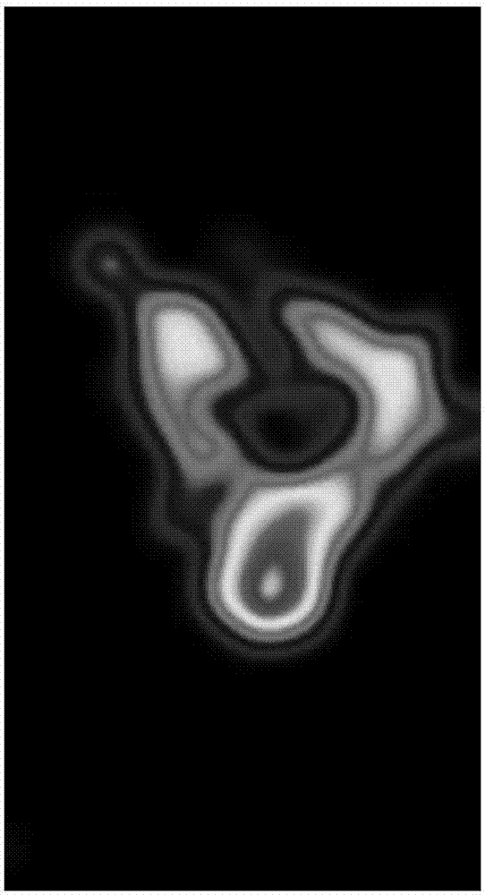 Deep residual network-based semantic mammary gland molybdenum target image lump segmentation method