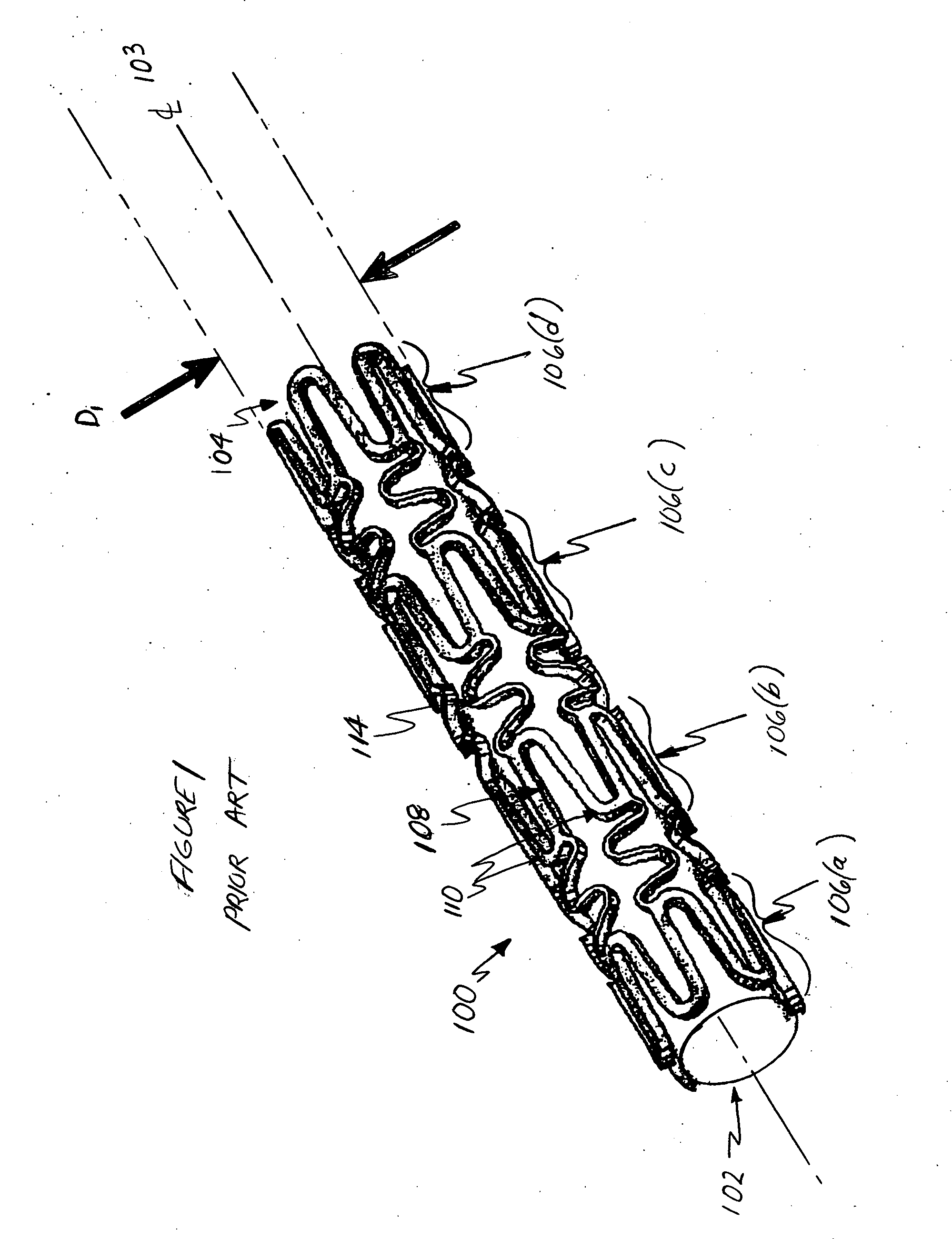 Optimized flex link for expandable stent