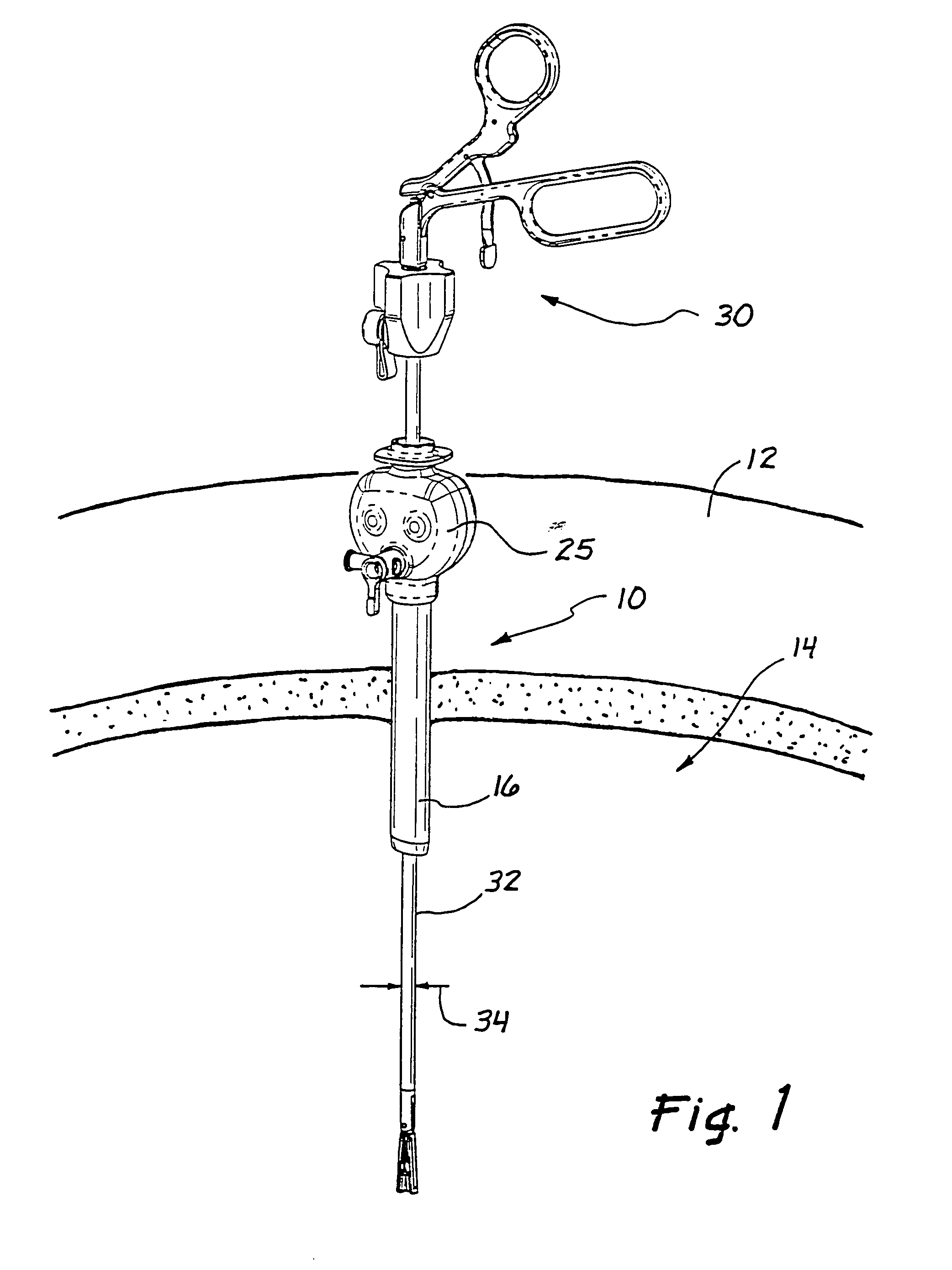 Access sealing apparatus and method