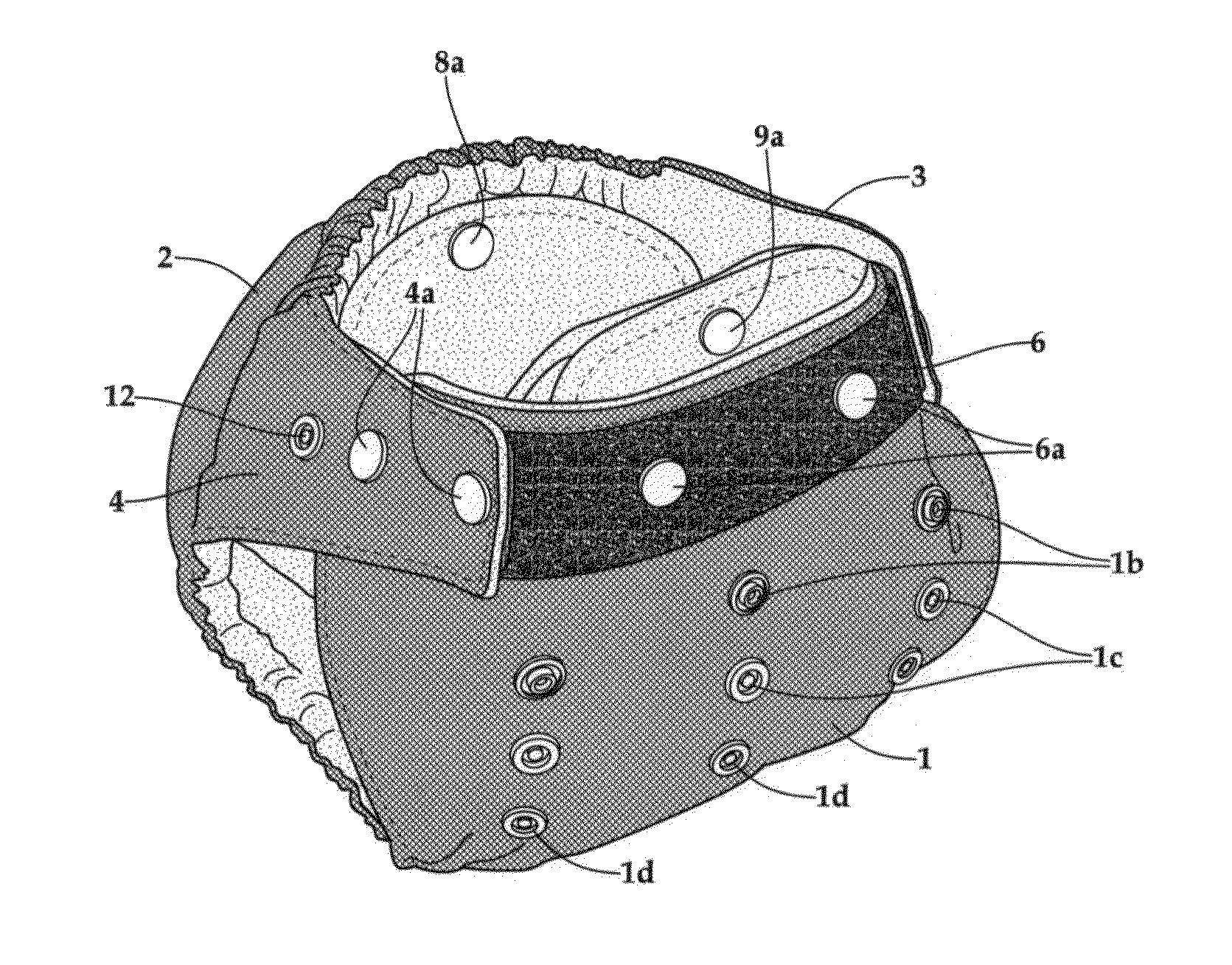 Cloth diaper with dual-closure system