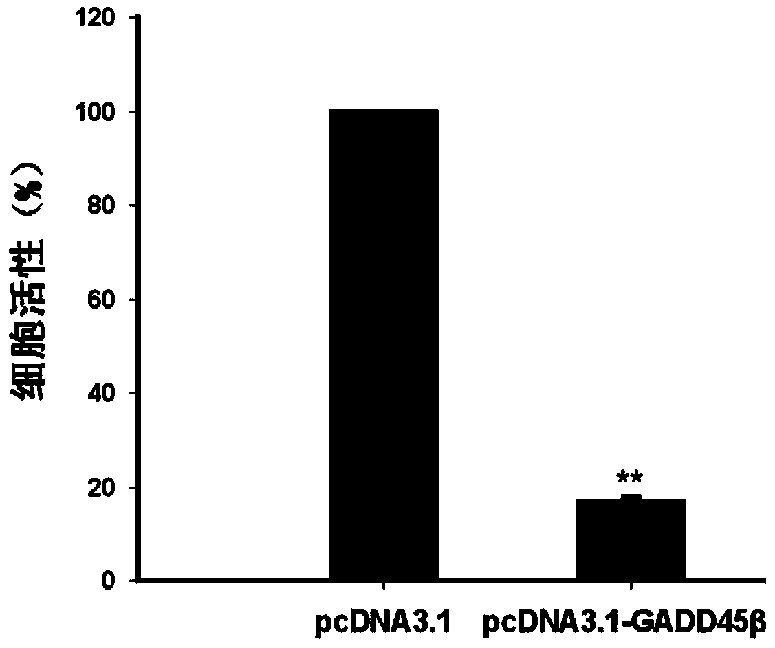 Application of gadd45β gene in preparation of anti-bladder cancer drug