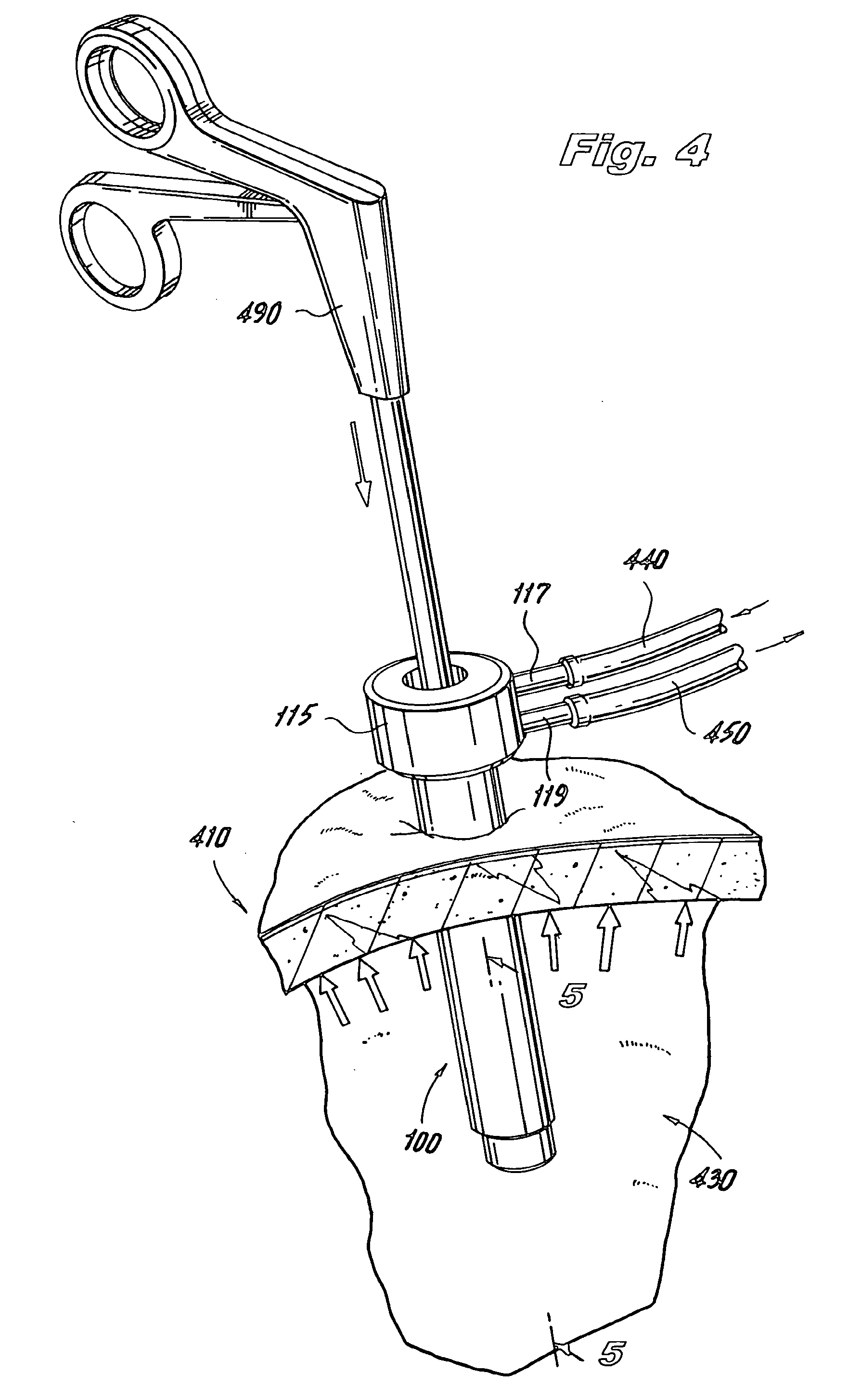 Trocar assembly with pneumatic sealing