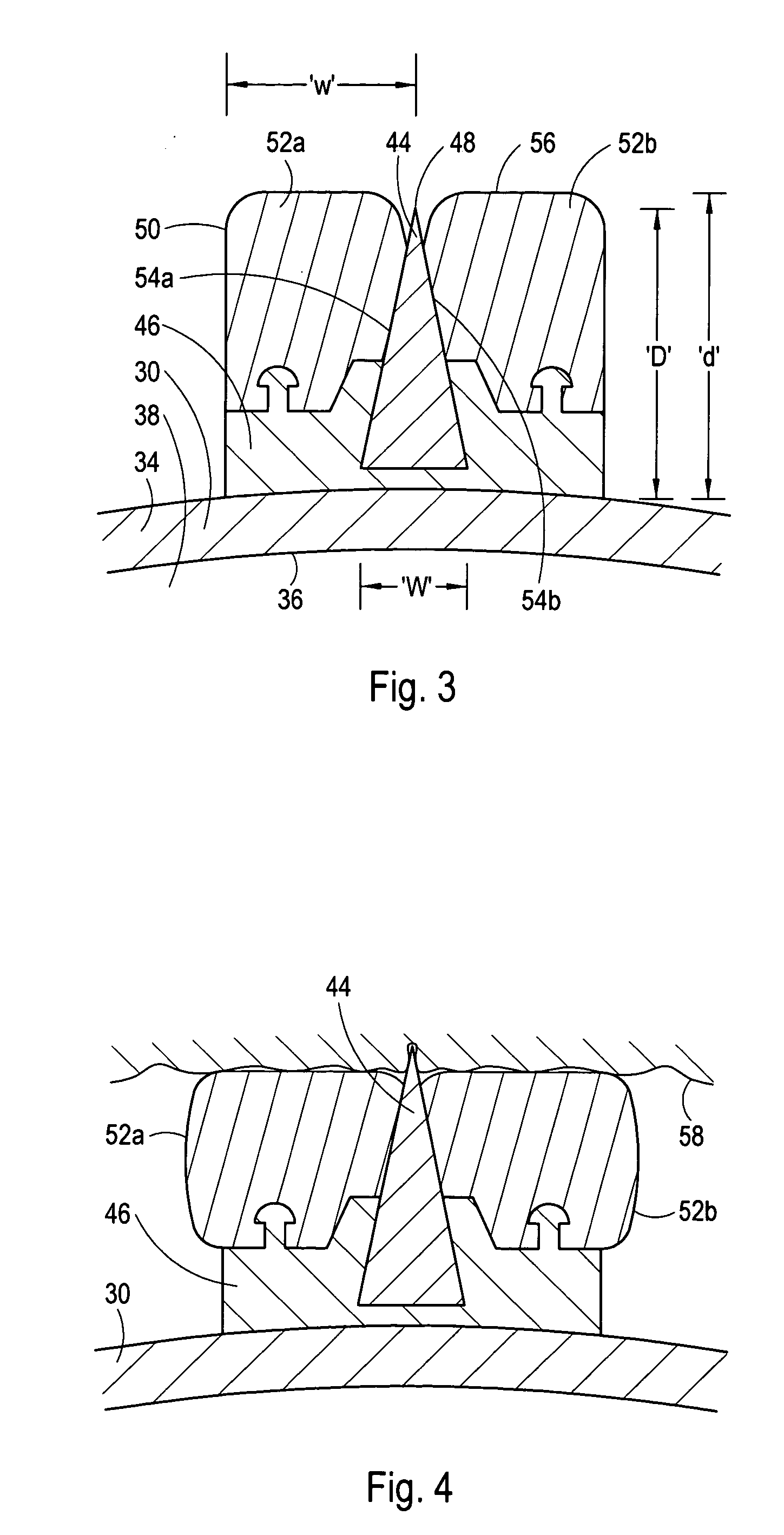 Cutting balloon having sheathed incising elements