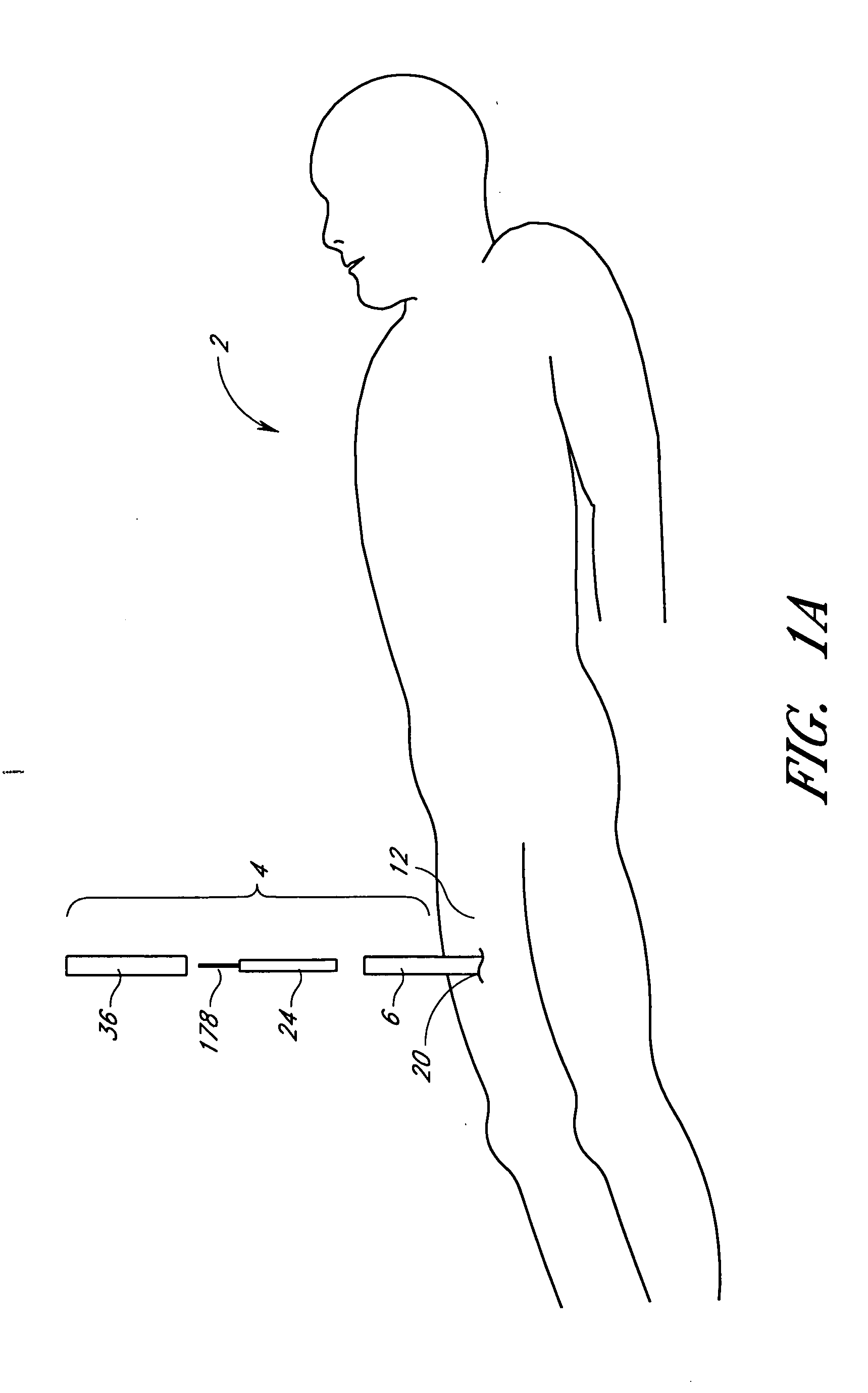 Suturing device and method for sealing an opening in a blood vessel or other biological structure