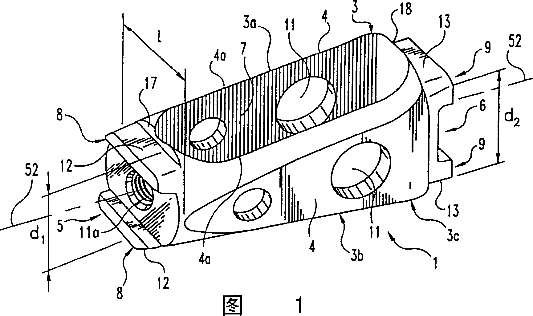 Spinal implant and cutting tool preparation accessory for mounting implant