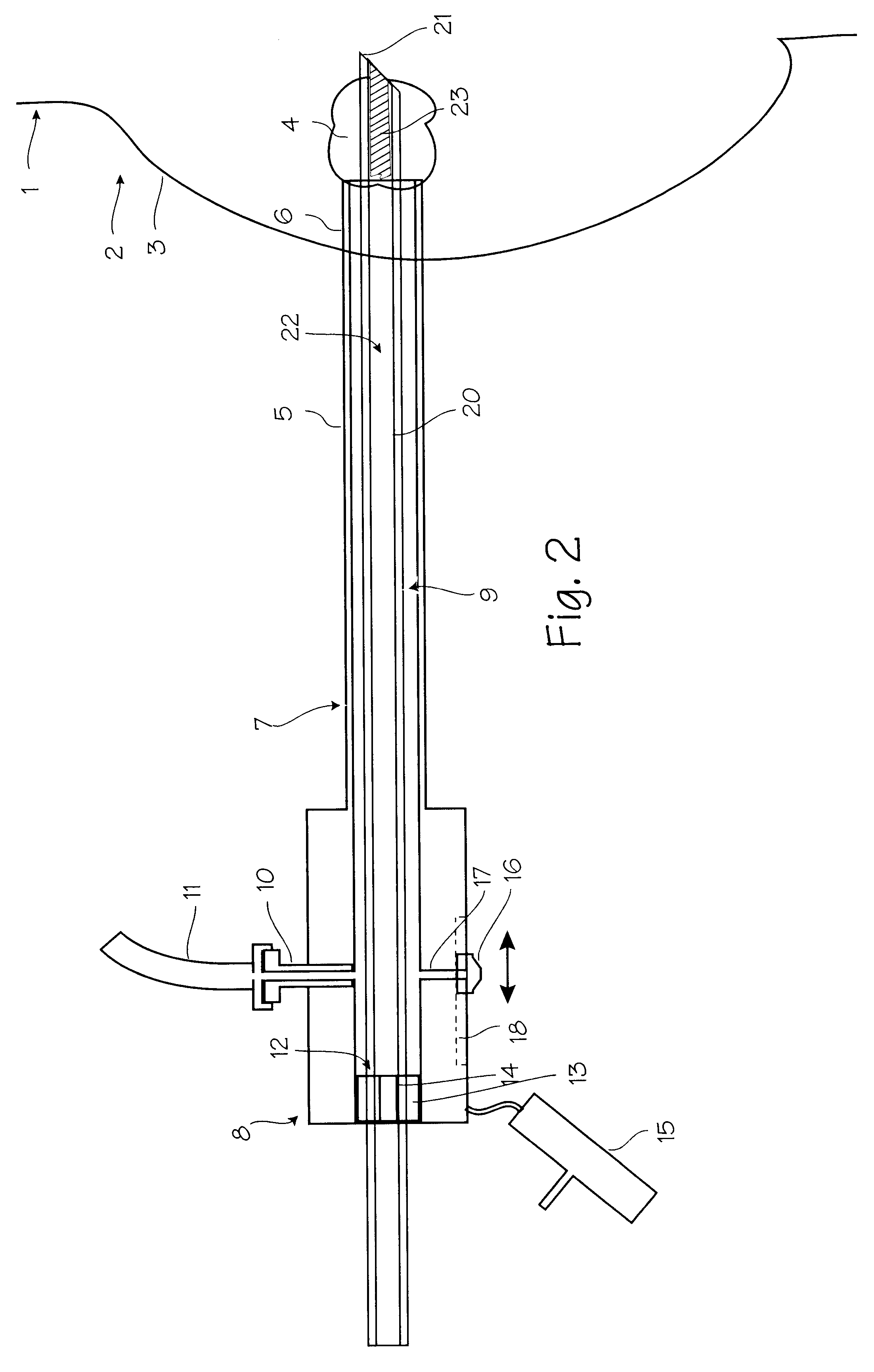 Device for biopsy and treatment of breast tumors