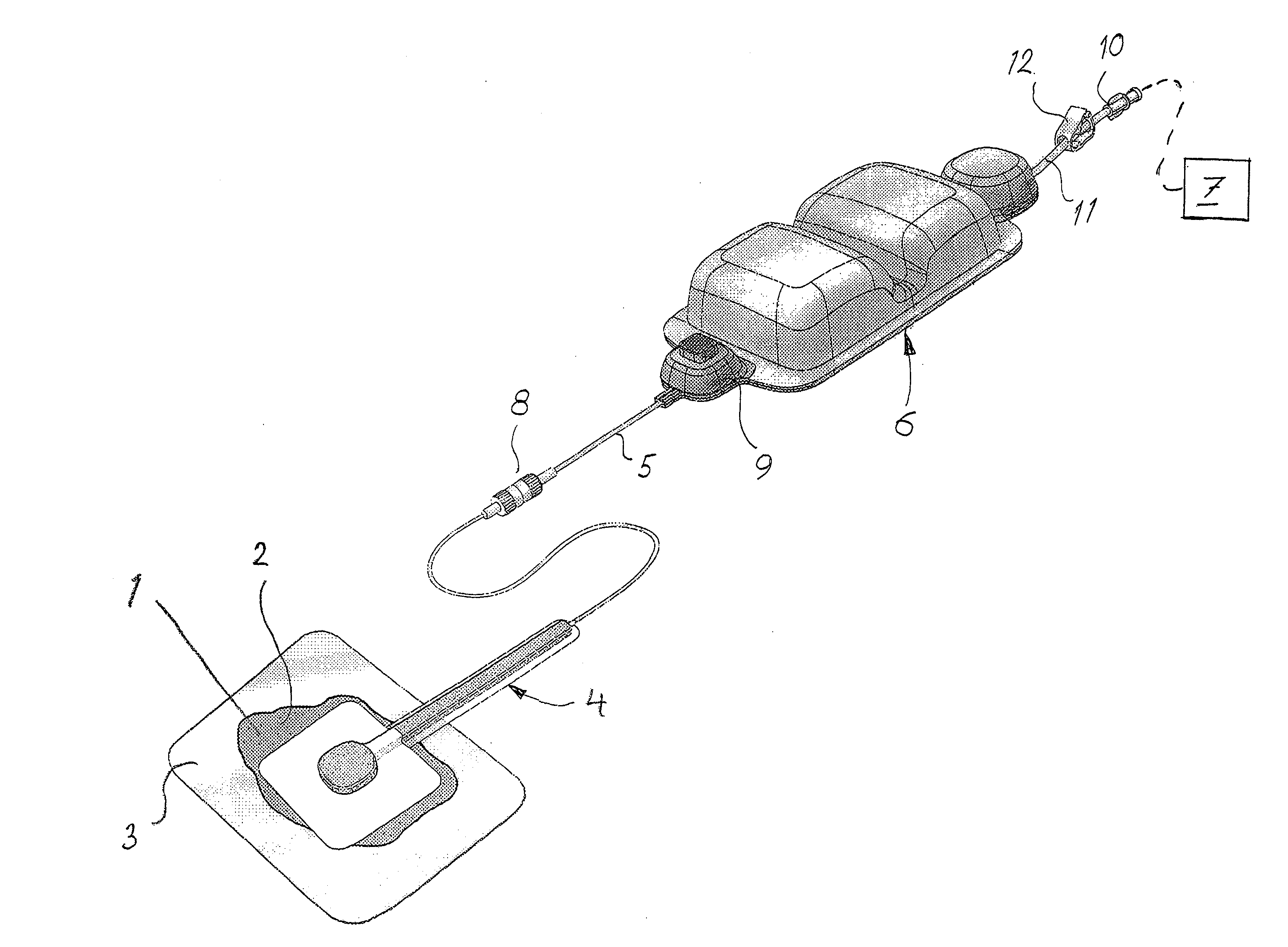 Device for tratment of wound using reduced pressure