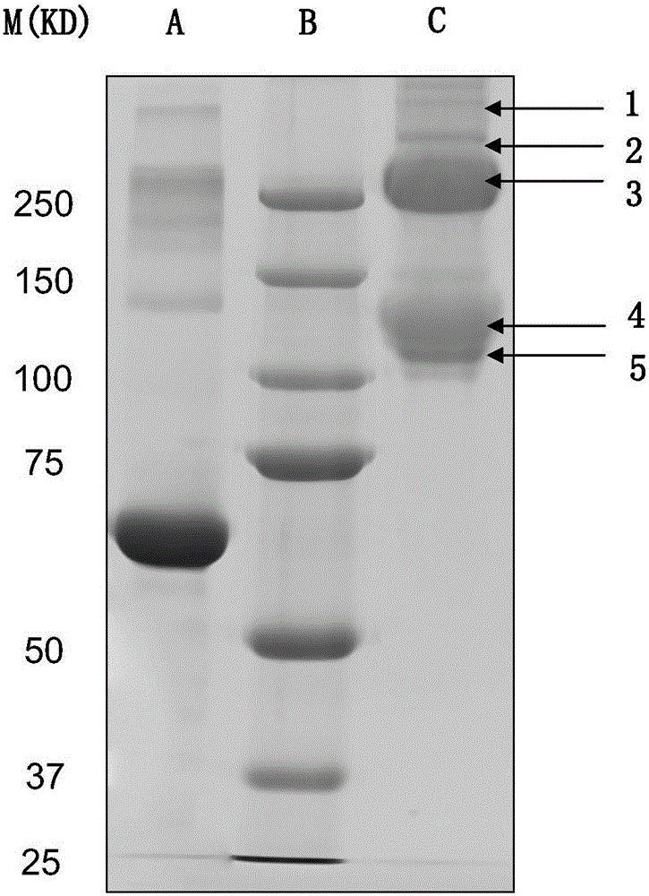 A kind of preparation method of fish skin collagen for medical grade biological material