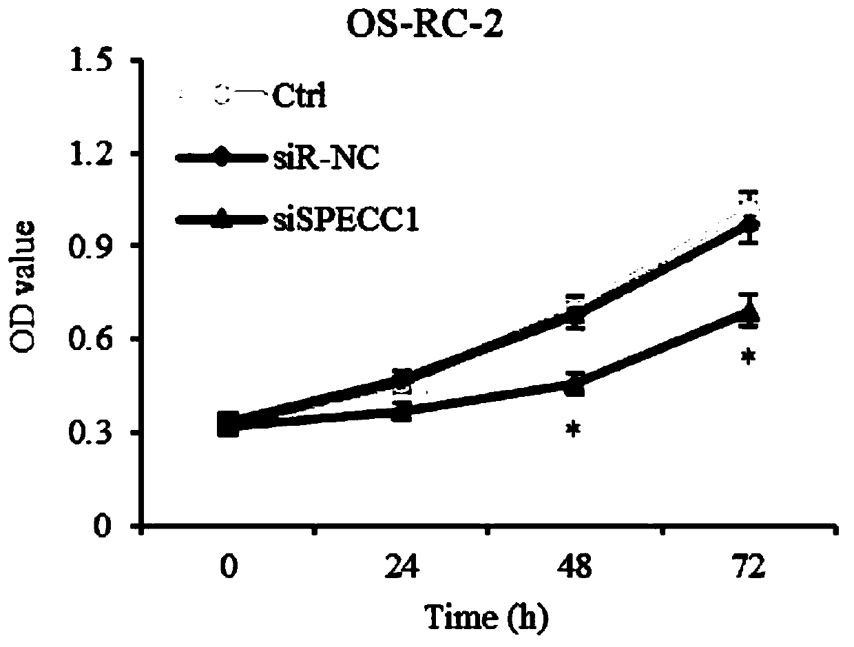 CircSPECC1 for treating human kidney cancer and application thereof