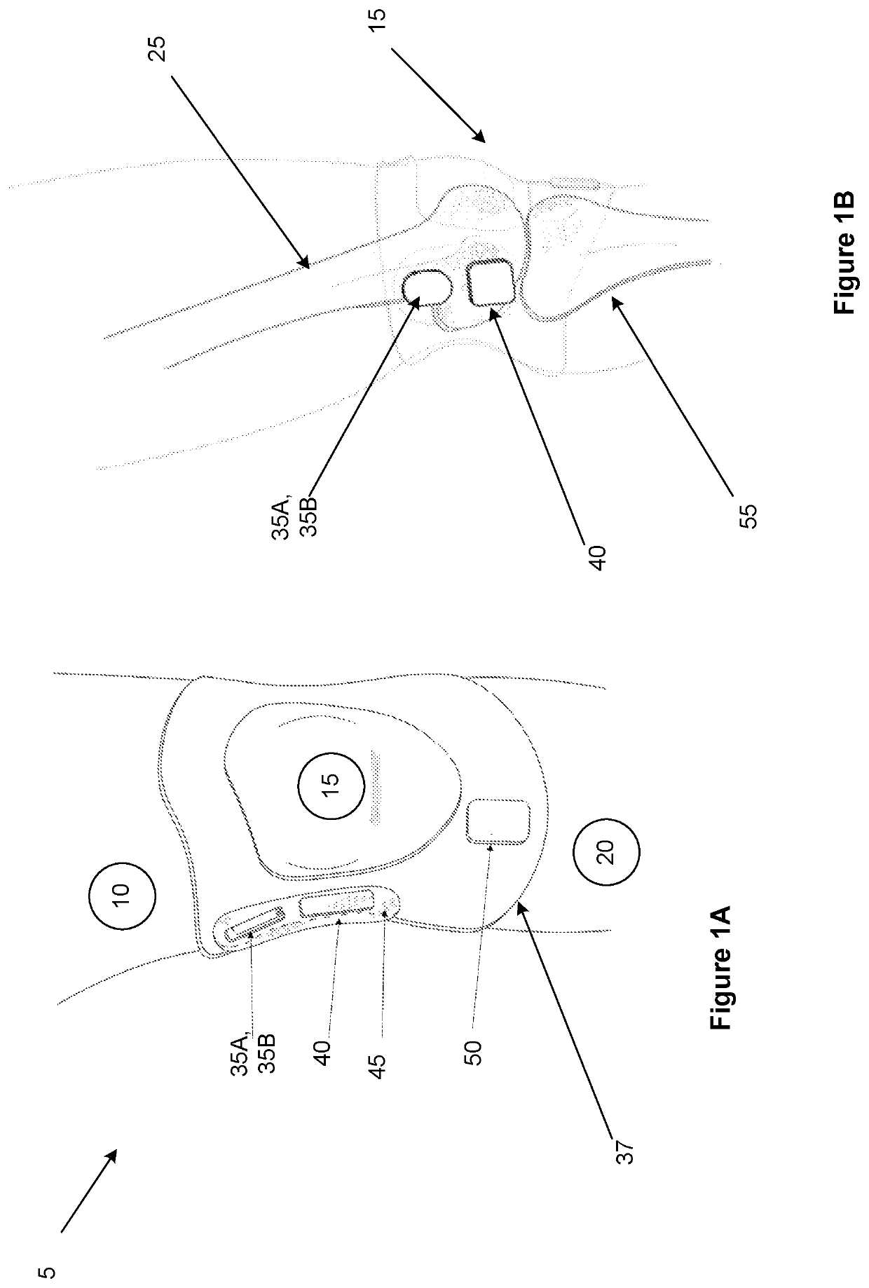 Method and device for measuring anatomical movement of a joint