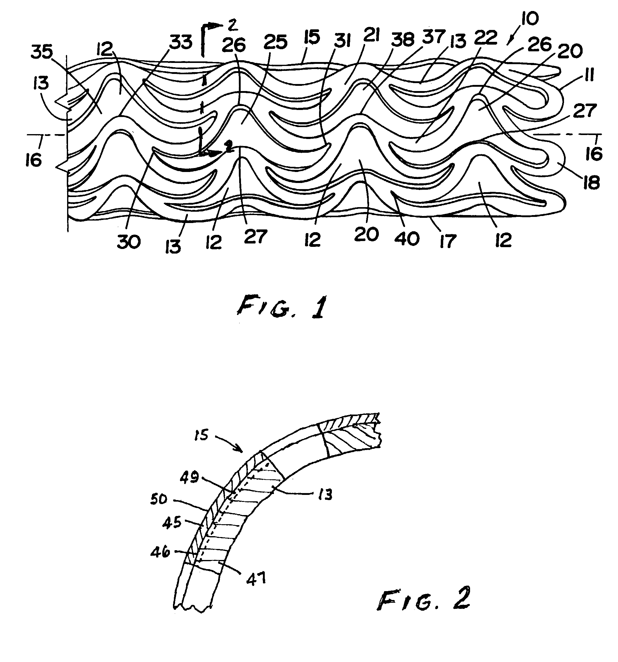 Metal stent with surface layer of noble metal oxide and method of fabrication