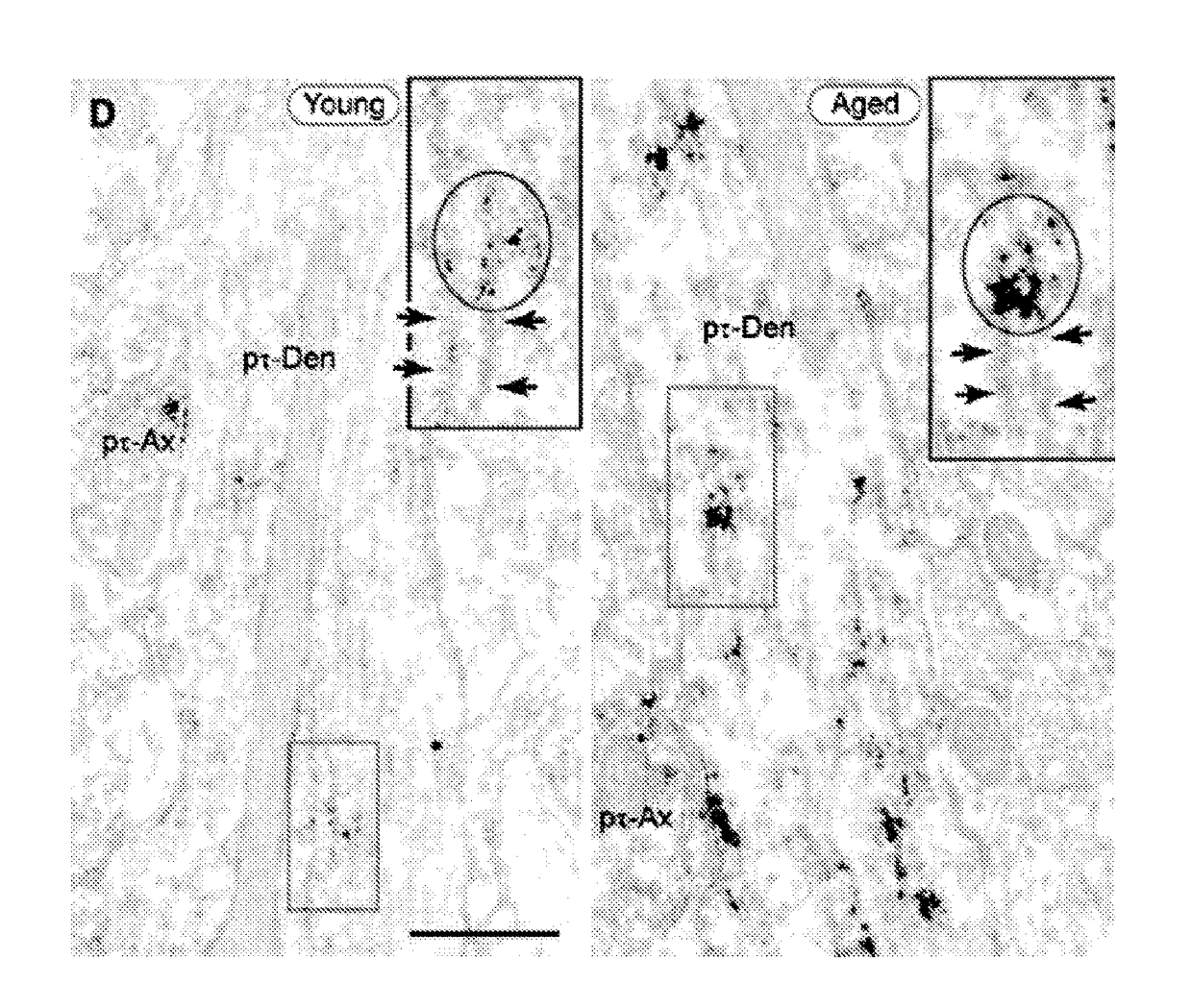 Methods of preventing neurodegeneration of association cortex in a mammal