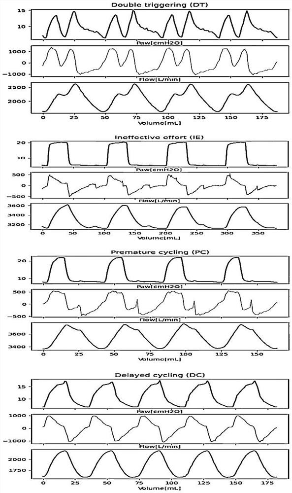 Method and device for classifying man-machine asynchronous phenomenon in mechanical ventilation process