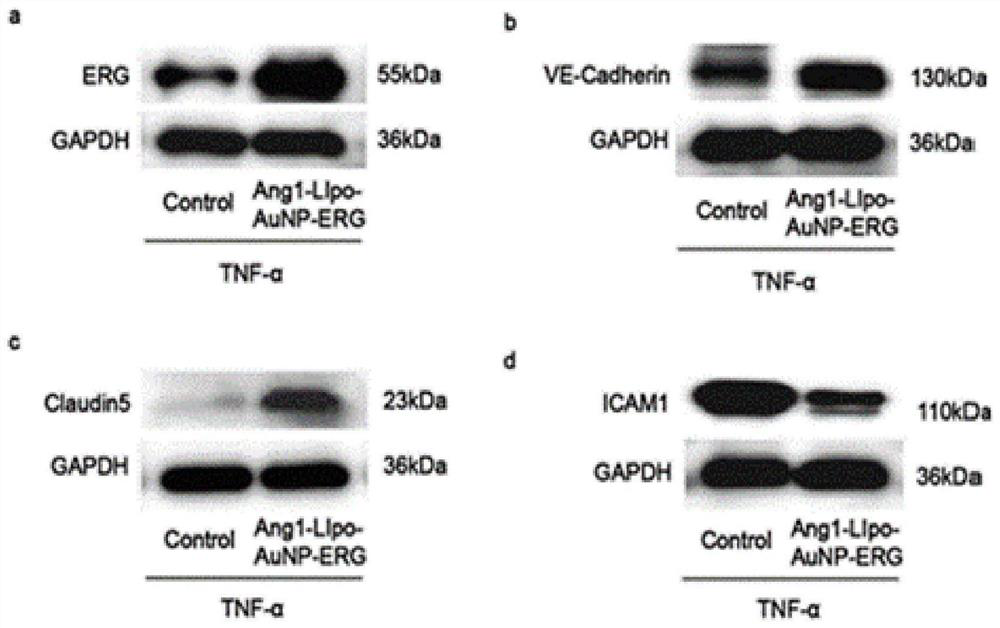 Lipid nanogold particle compound and application thereof in delivering ERG and treating encephaledema disease