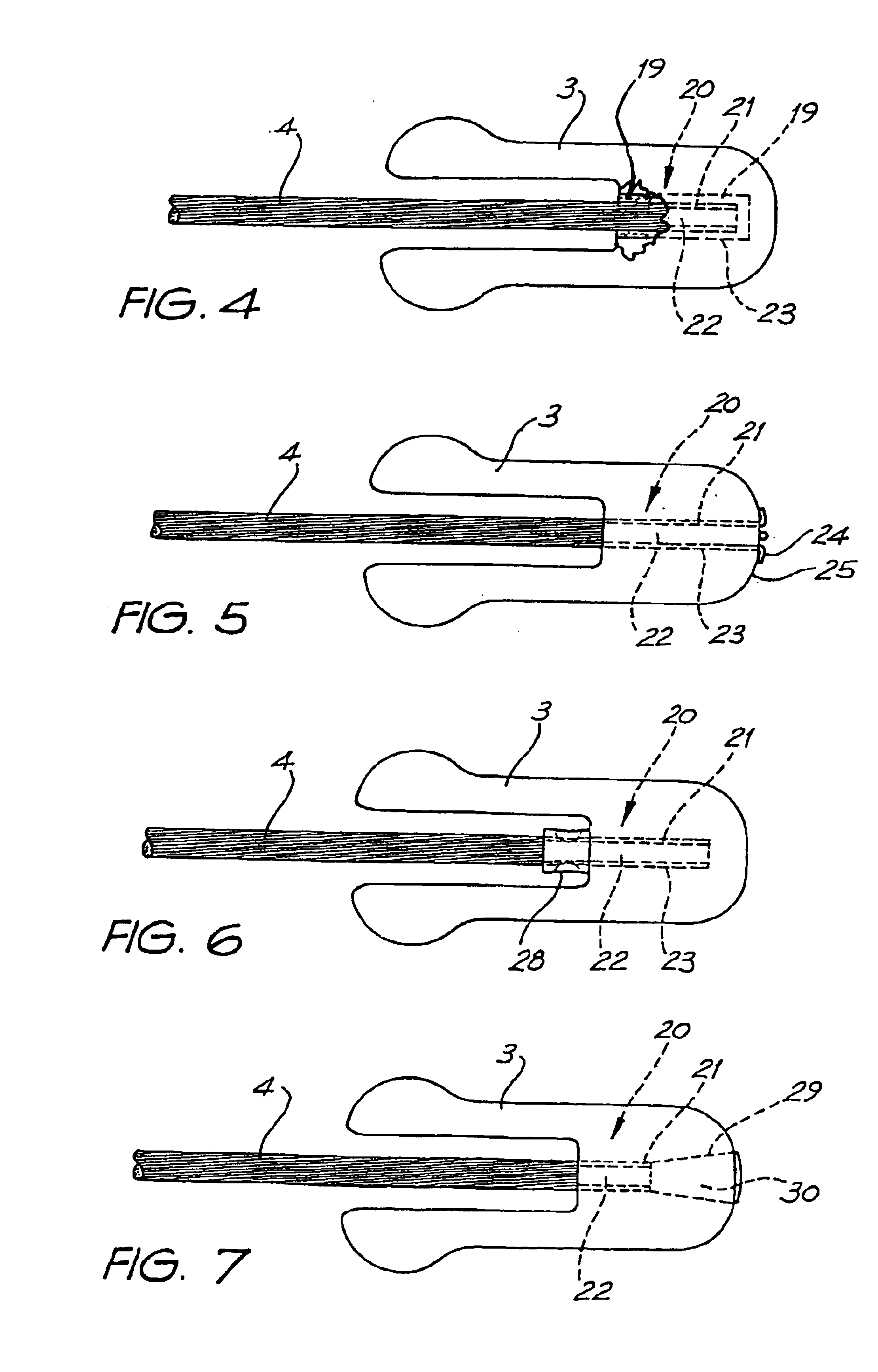 Vibration damper for overhead power lines