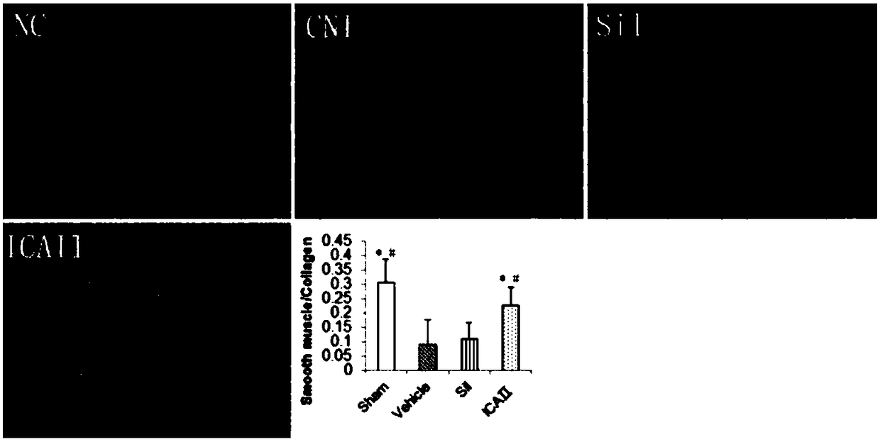 Application of icarisid II or medical carrier of icarisid II to prevention and/or treatment of erectile dysfunction