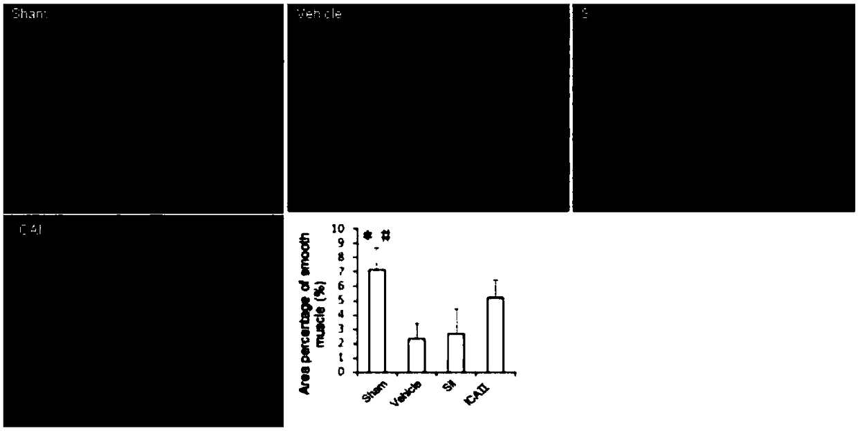 Application of icarisid II or medical carrier of icarisid II to prevention and/or treatment of erectile dysfunction