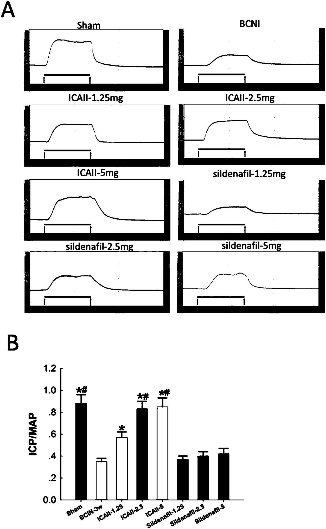 Application of icarisid II or medical carrier of icarisid II to prevention and/or treatment of erectile dysfunction